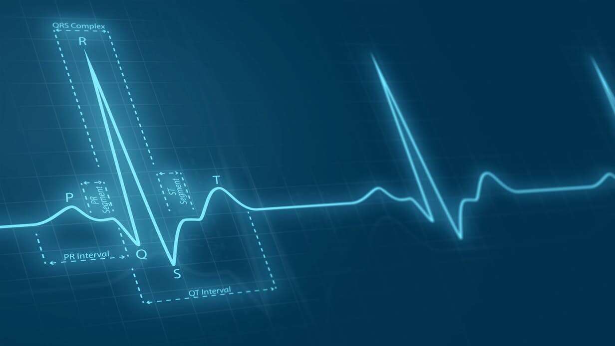 EKG, SI EKG, sztuczna inteligencja EKG, analiza EKG