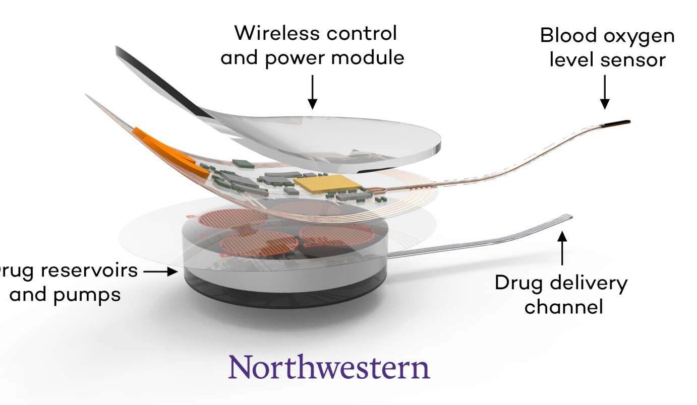 Ten implant uratuje Cię po przedawkowaniu opioidów