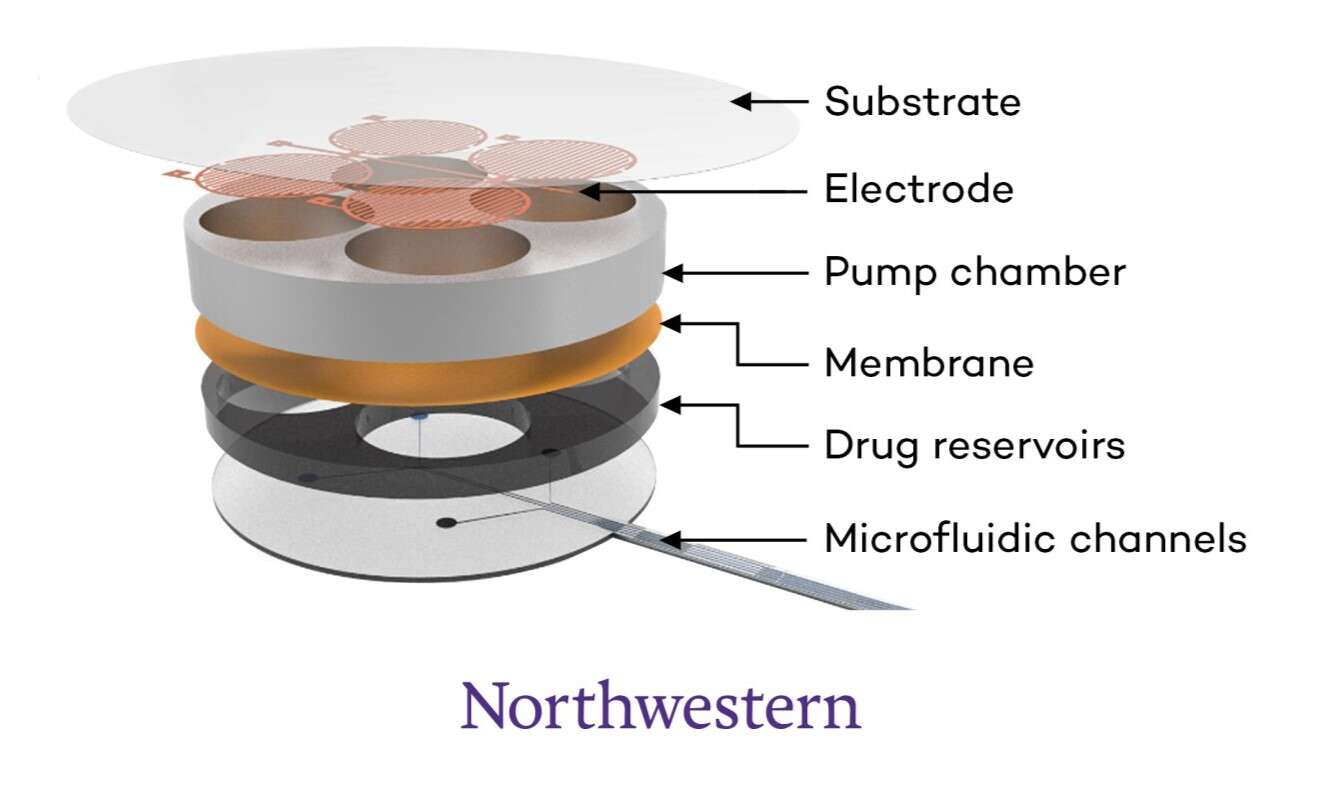 Ten implant uratuje Cię po przedawkowaniu opioidów