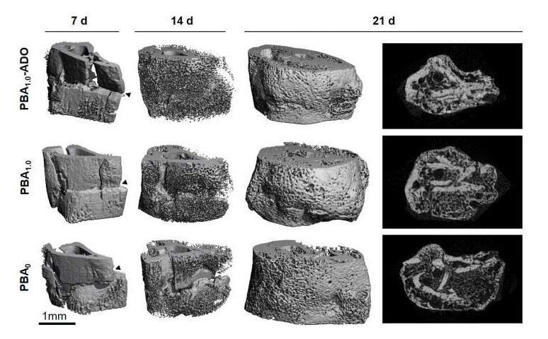 bandaż na kość, leczenie złamanych kości, odbudowa kości, andonezyna na kości