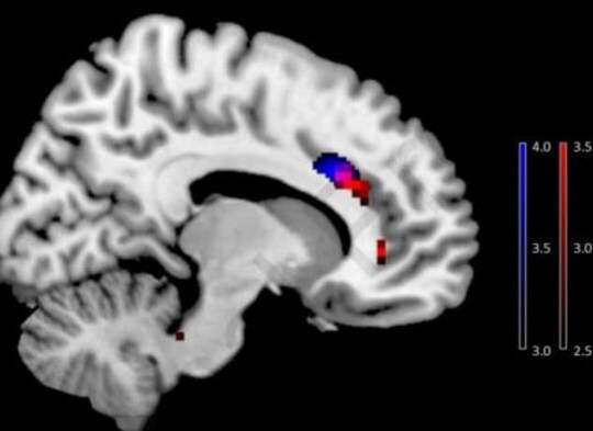 Uzależnienie od smartfona powoduje fizyczne zmiany w mózgu
