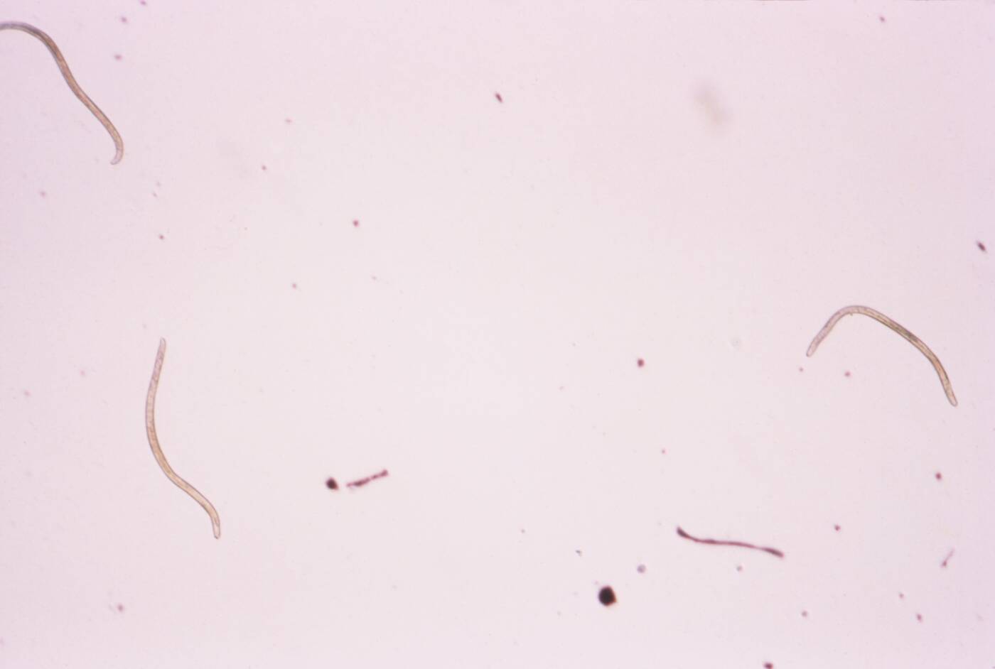 7 (prawie) całkowicie zwalczonych chorób