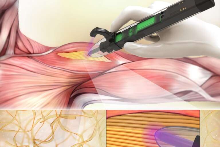 Przenośna drukarka 3D umożliwia tworzenie tkanki mięśniowej