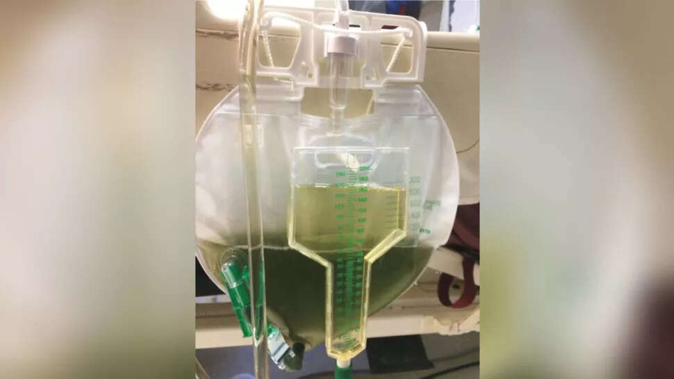 Mocz tego mężczyzny stał się zielony. Teraz wiemy, dlaczego