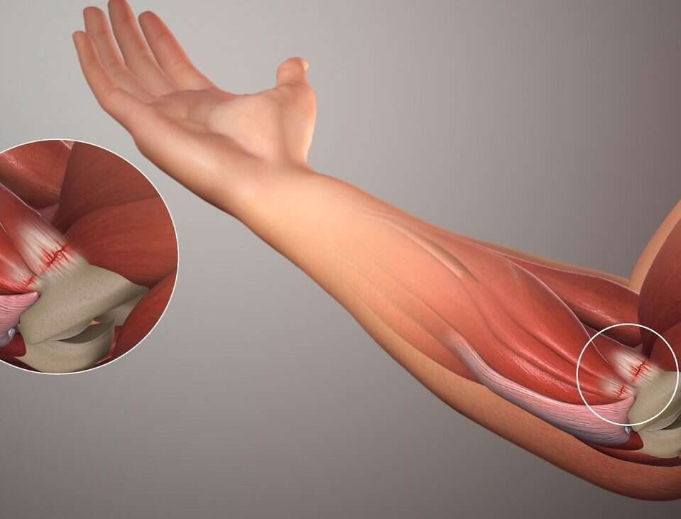 Skąd bierze się silny ból łokcia po uderzeniu?