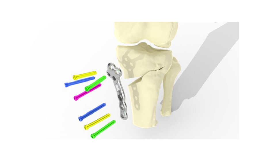 Implanty drukowane w 3D mogą stanowić rozwiązanie problemu dotyczącego milionów osób