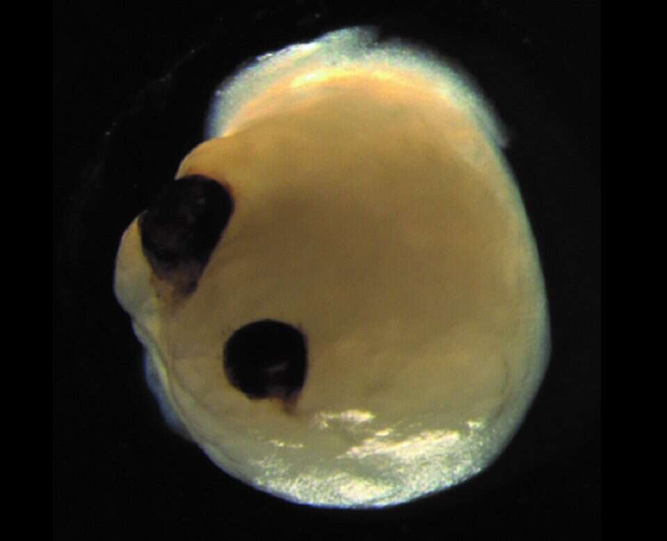 Wyhodowali mózgi z komórek macierzystych, które samoczynnie wytworzyły oczy