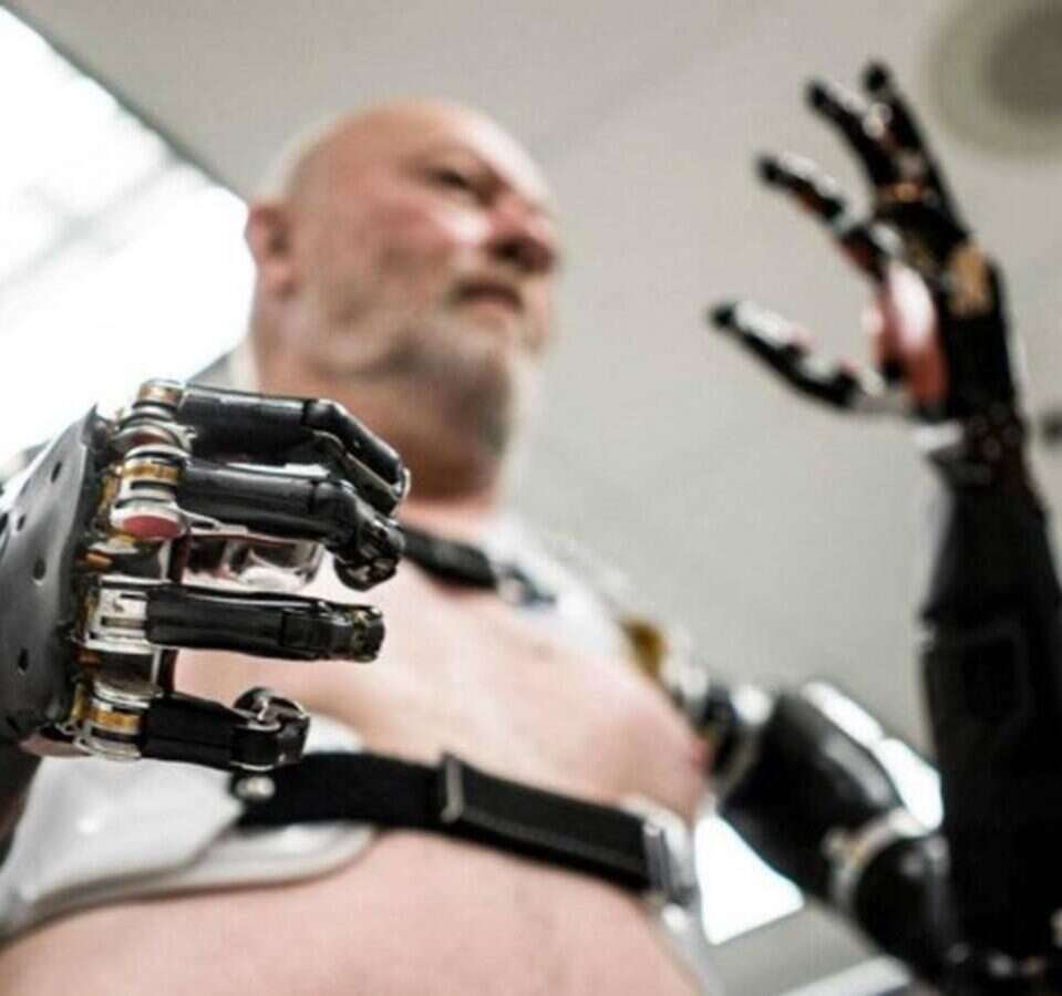 Atom Touch, zaawansowana proteza ręki