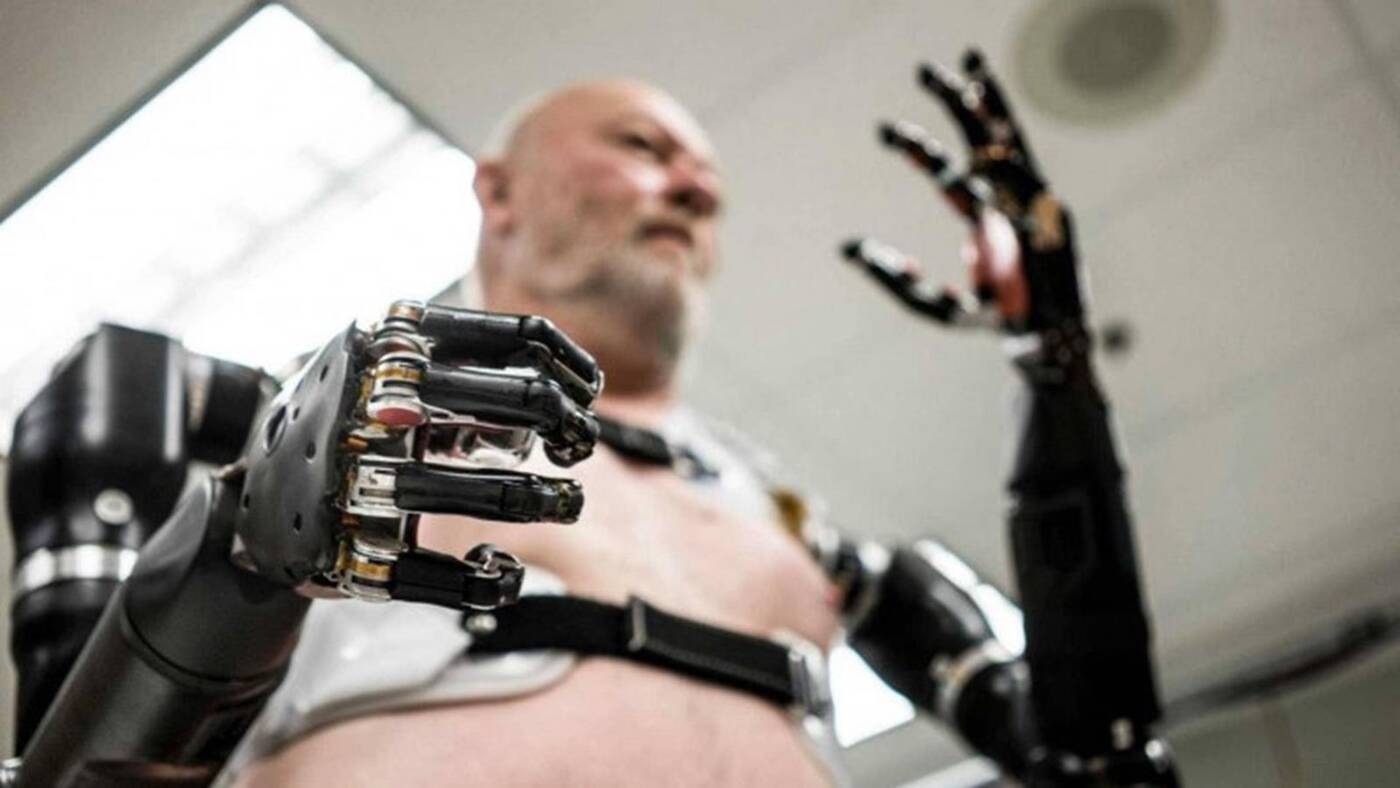 Atom Touch, zaawansowana proteza ręki